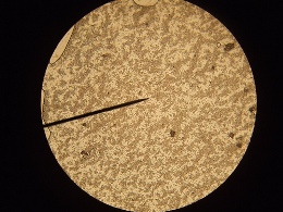 Candida yeast infection treatment